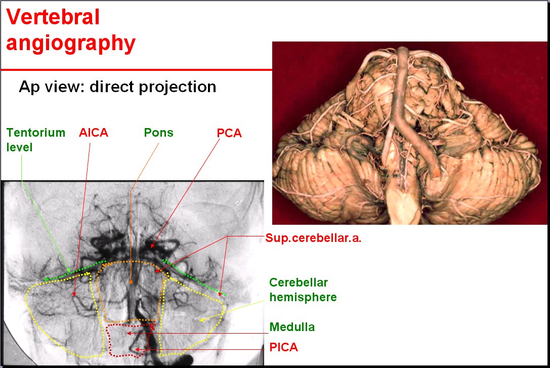 Salamon S Neuroanatomy And Neurovasculature Web Atlas Resource